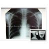 Buy cheap Digital Medical X Ray Dry Film 14 x 17inch Health Imaging Radiographic Film from wholesalers
