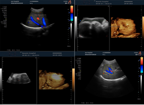 4d Image Technology Color Doppler Ultrasound Scanner For Pregnancy Ultrasound