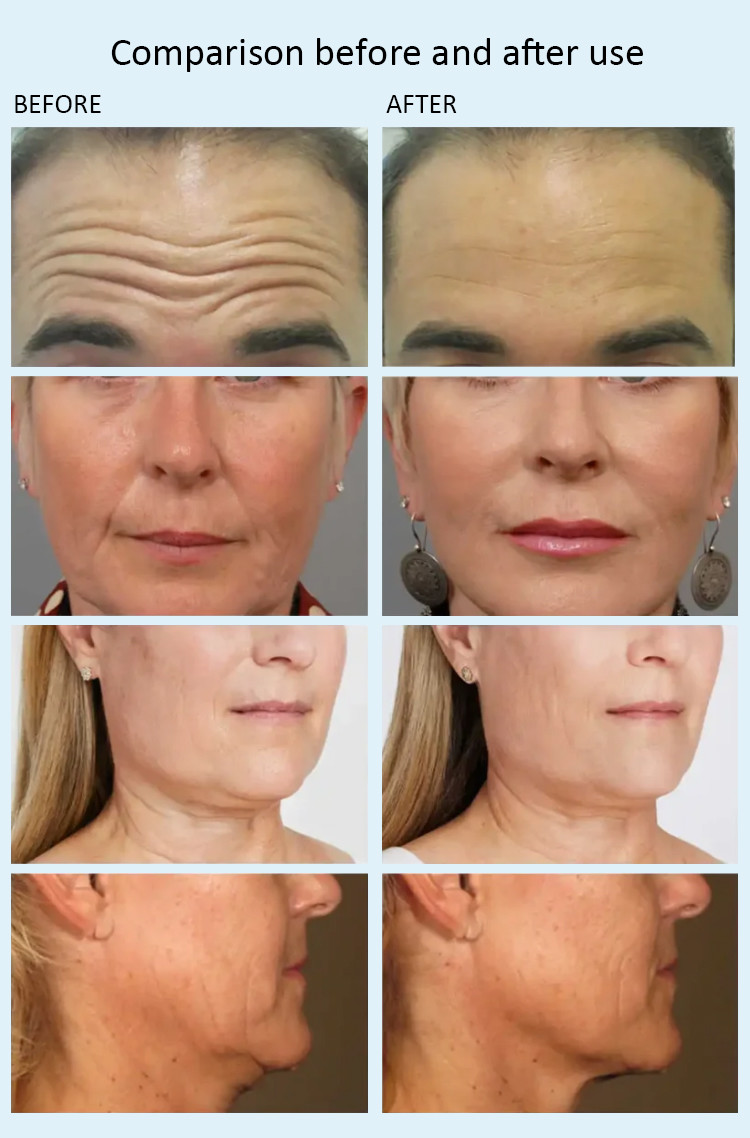 Astiland Care Face Lifting Electric Massage Facial Muscle Sculpting Machine Ems For Face