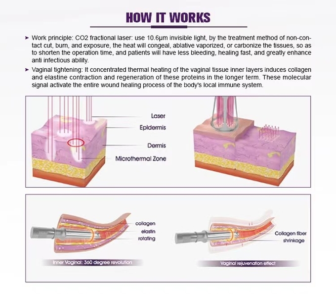 Professional C02 Vaginal Tightening Laser/Skin Resurfacing CO2 Fractional Laser Machine