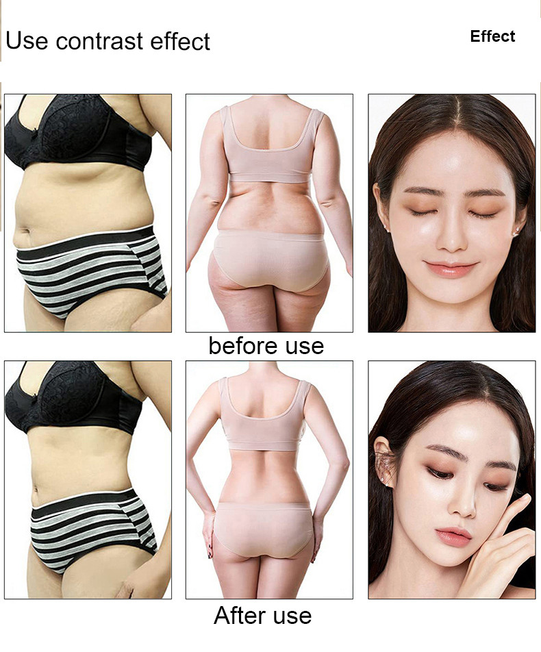 6 In 1 Ultrasonic Cavitation Machine