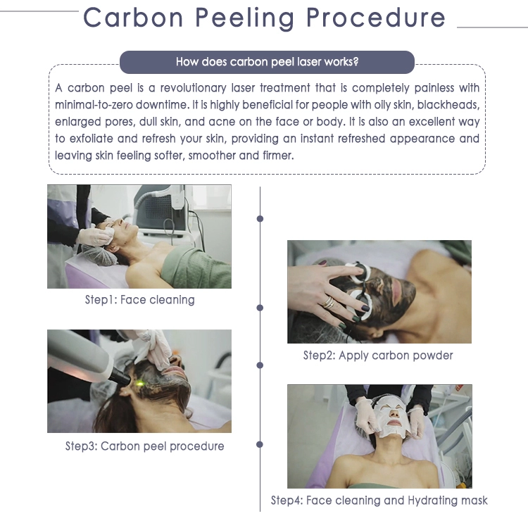 Picosecond Carbon Laser Peel Machine