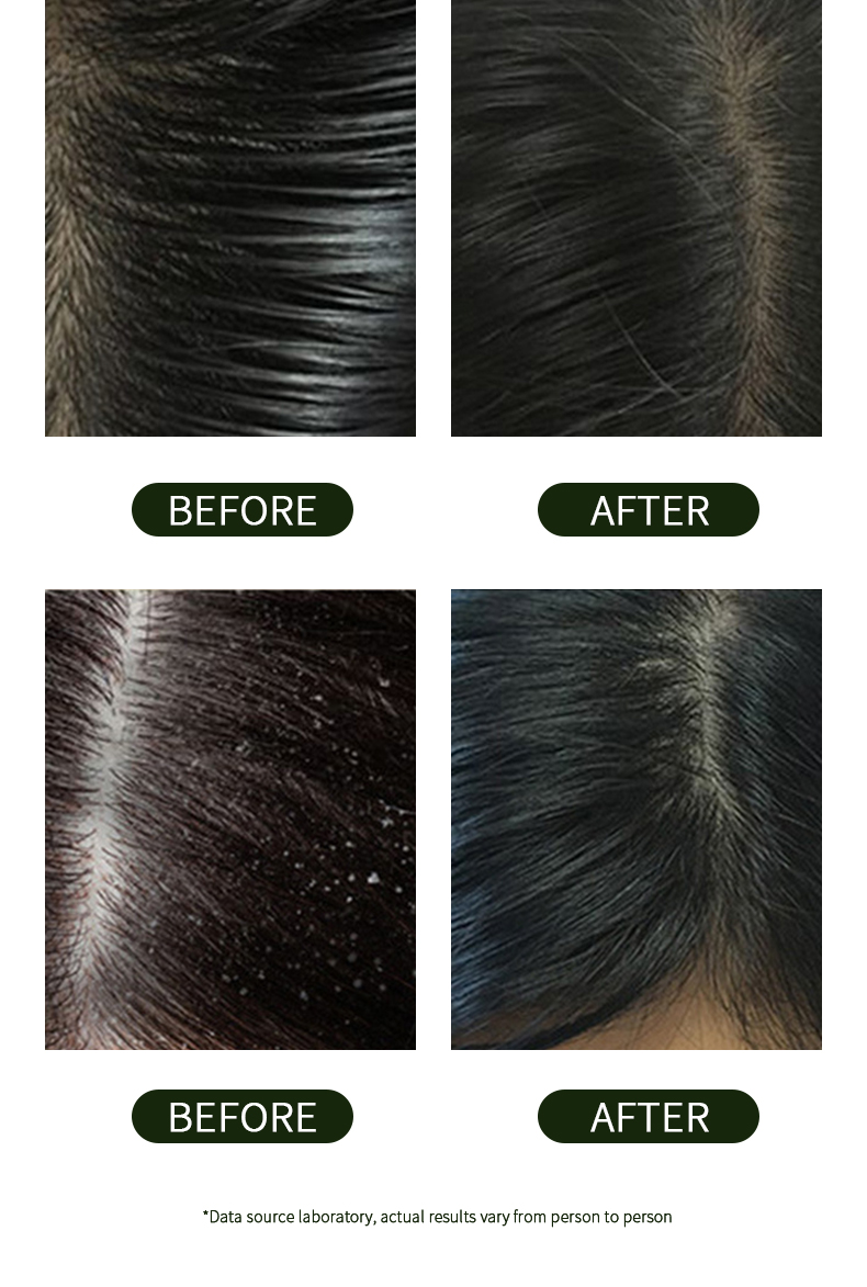 Hydrates And Nourishes Hair And Scalp Long Lasting Fragrance Simply Grow With Activation Shampoo De Rosemary