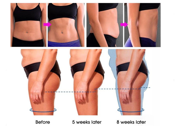 Rf Vacuum Lasertell Laser Lipo Cavitation Machine Body Sculpting Slimming Medical