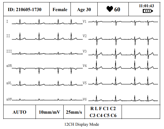 20x240 Dot Monochrome LCD Screen Display Assembly LM2068BCW for EDAN SE-300 SE-300B ECG EKG 3-Channel Machine
