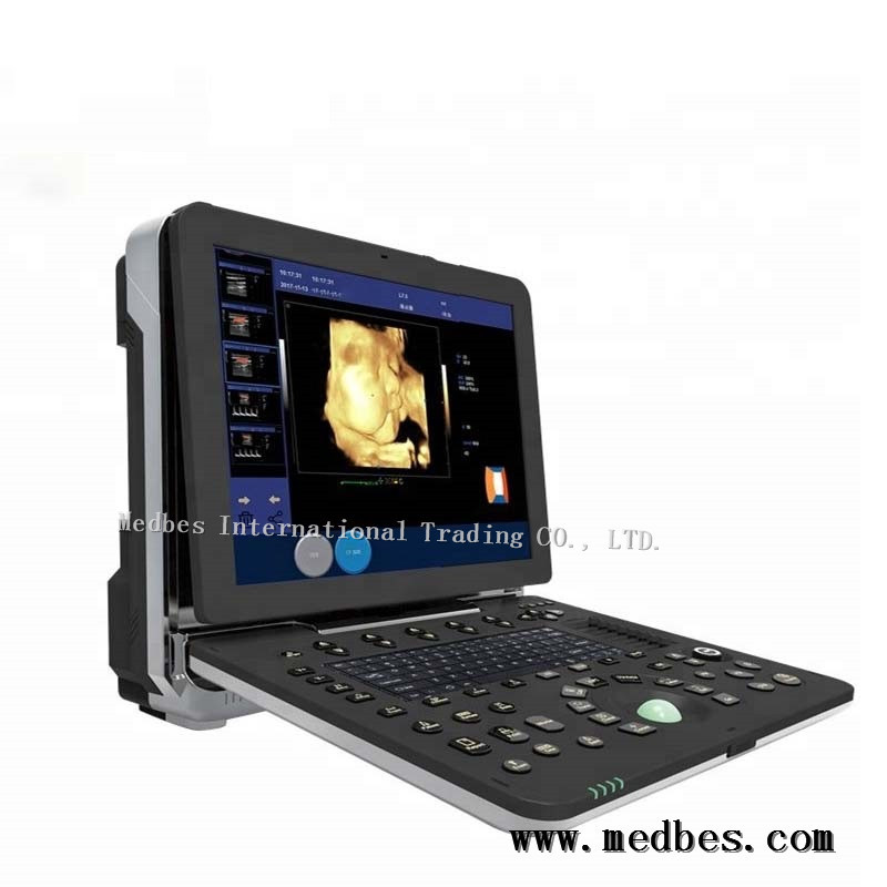4D Realtime Musculoskeletal Ultrasound Systems fetal doppler ultrasound Ultrasound Diagnosis System