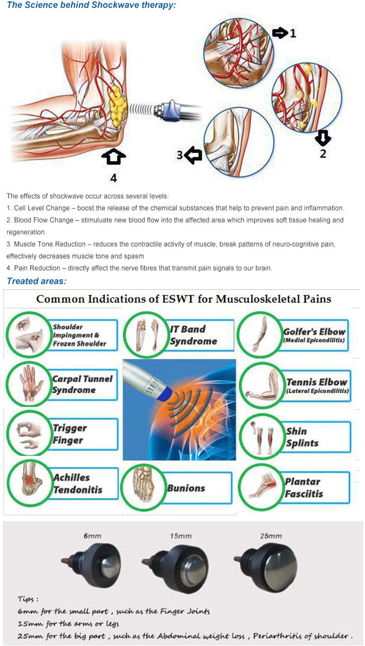 Extracorporeal Shock Wave Therapy Machine Shockwave Treatment For Plantar Fasciitis