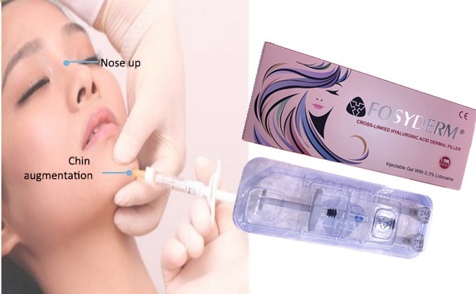 Fosyderm HA Dermal Filler Gel Injectable Nose Lips Filler 24mg/ml