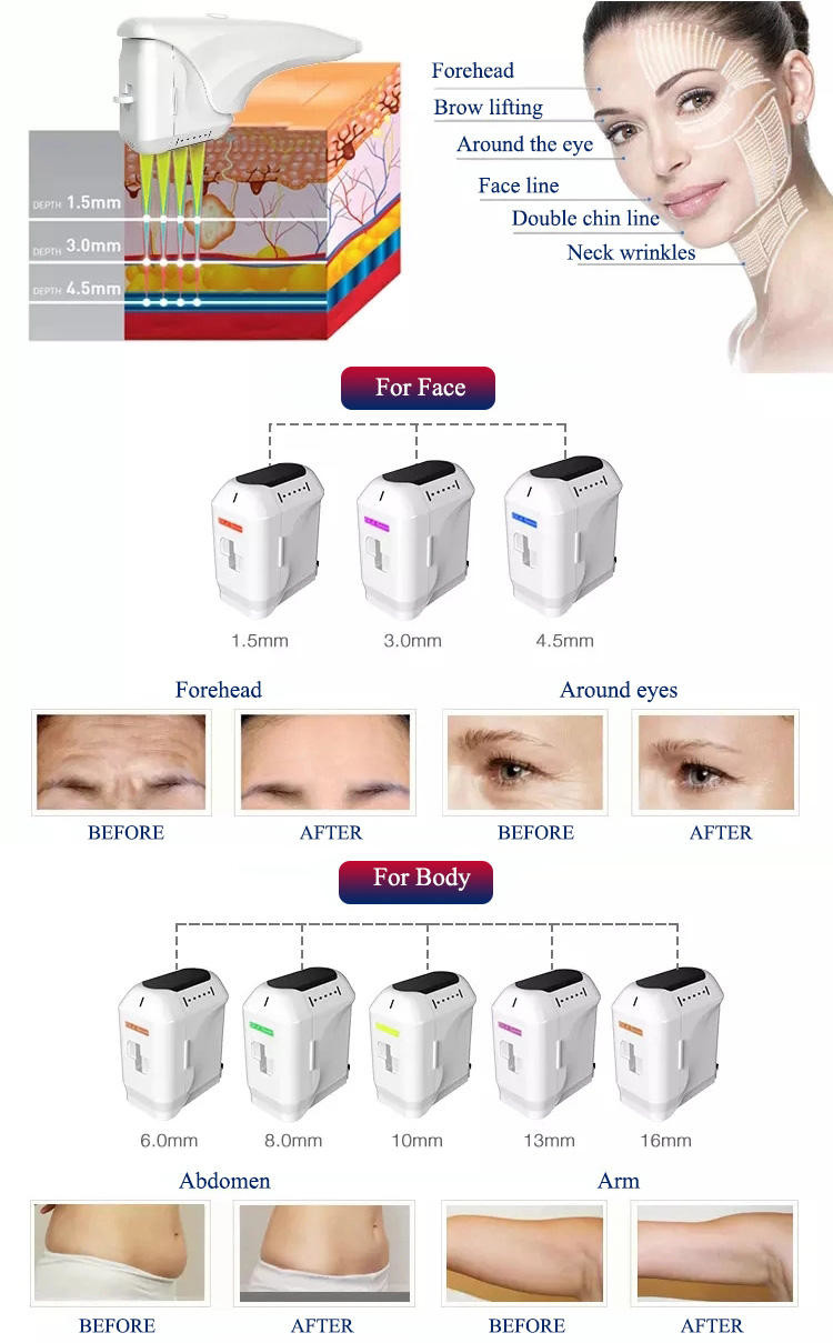 Breast Pulling 4D HIFU Anti Wrinkle Machine 12 Lines HIFU Power V Max Lift