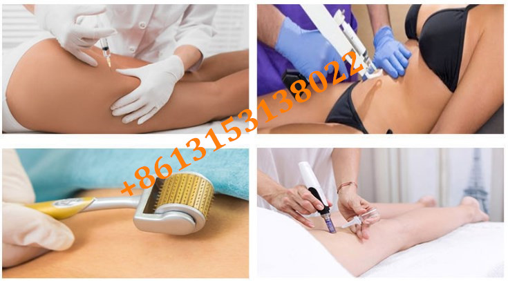 Hyamely Lipolysis Injection Face Body Slimming Lipodissolve Fat dissolve