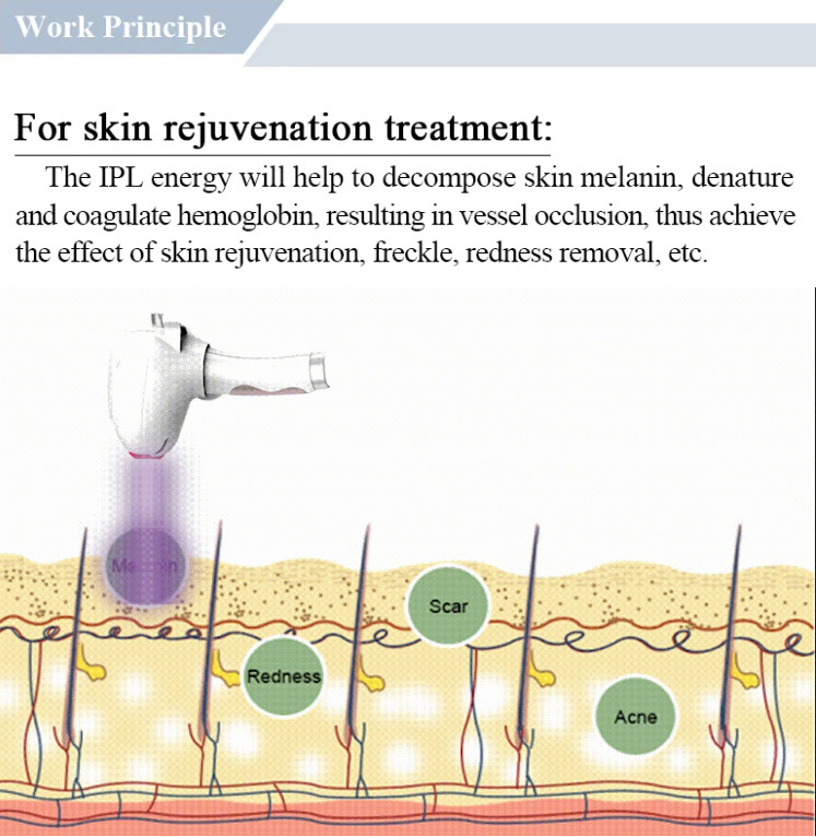 Multifunctional Ipl Opt Elight Hair Removal Skin Care Wrinkle Removal Machine