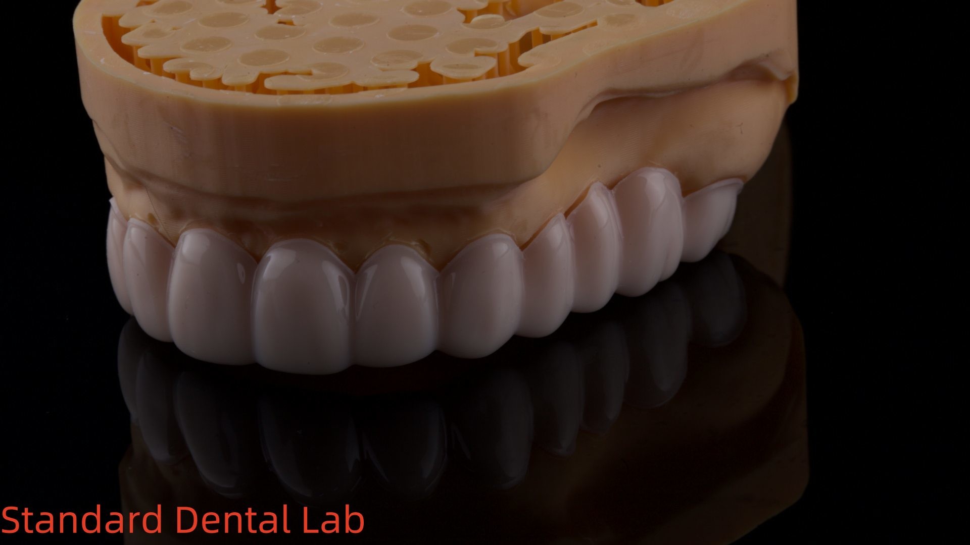 High Esthetics Dental Snap On Smile Standard Dental Lab Removable Dental Appliance