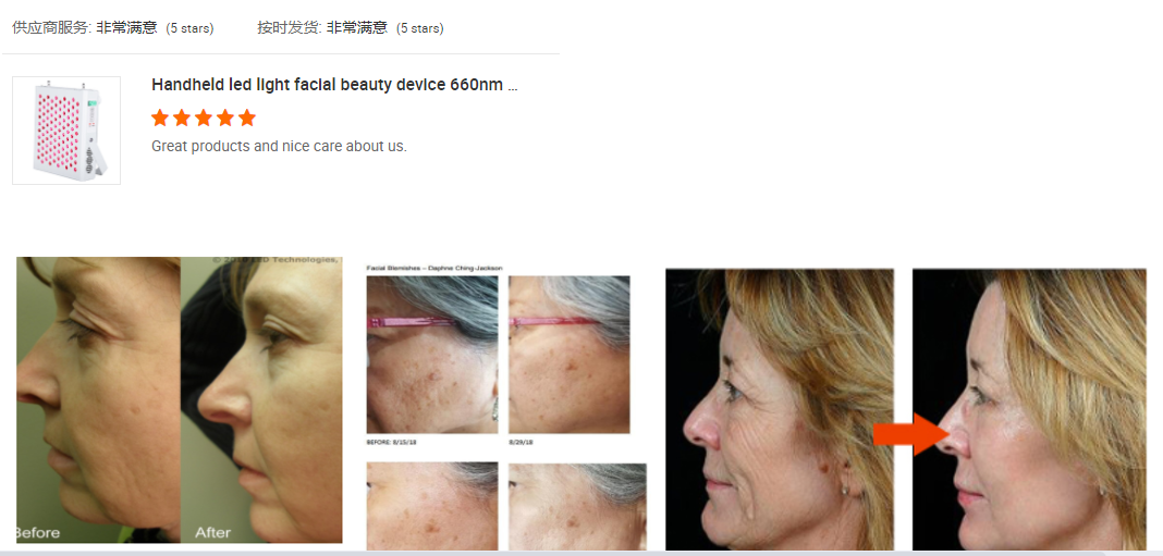 Collagen Nanoleaf LED Light Therapy Panel 300*5W For Skin Tightening