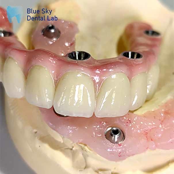 Universal Multiple Choices Implant Cases Designed For Smooth Surface And Sterile Steam Cleaning