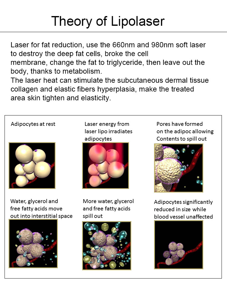 Laser Lipolysis Machine / Body Shaping Fat Loss LED Lipo Light Machine