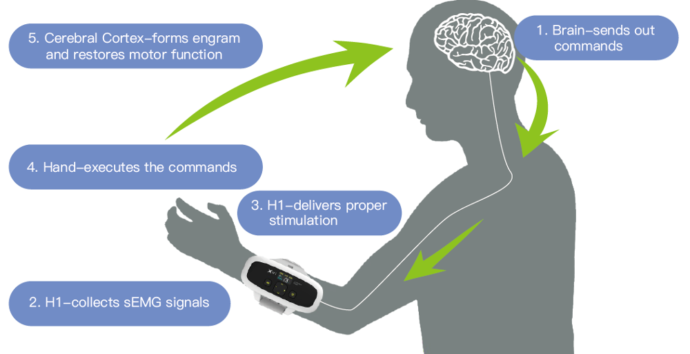 Hand Splint E - Stim Hand Rehabilitation Device Beautiful Appearance