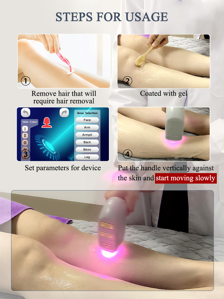 2000W Hair Removal Diode Laser 755 808 1064 / Diode Laser Hair Removal
