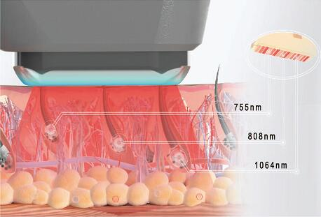 Permanent Painfree Diode Hair Removal Laser Machine 1 - 10Hz Frequency