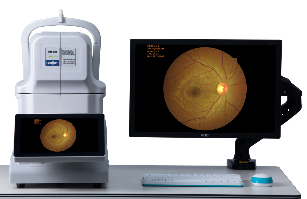 DICOM AI 240v Non Mydriatic Fundus Camera 2.8mm Pupil Size