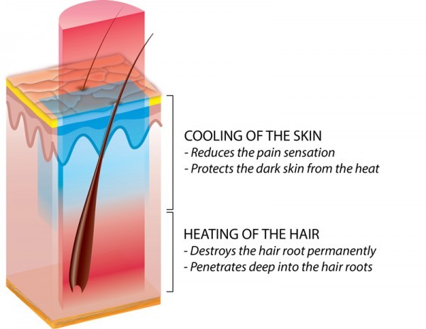 E-light ipl rf+nd yag laser multifunction machine intense pulsed light