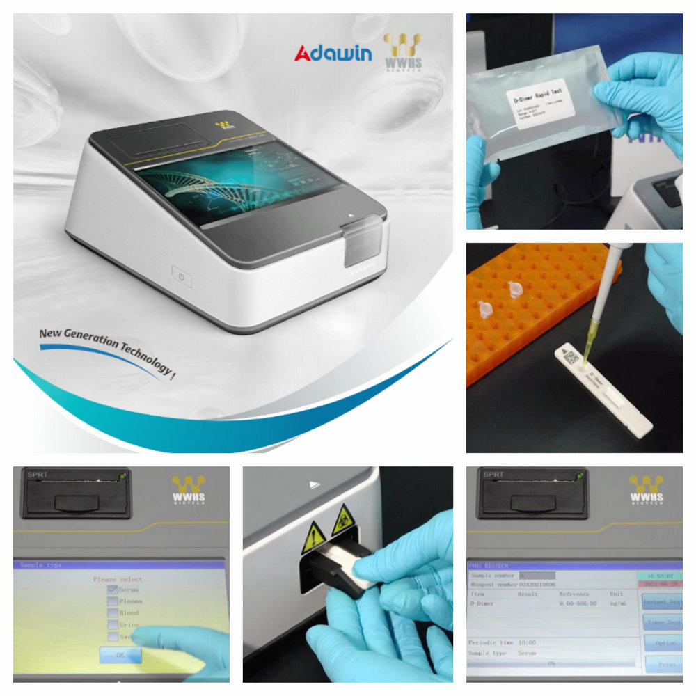Wide Range Diagnostics PSA Rapid Test Kit POCT IVD Tumor Marker Detection