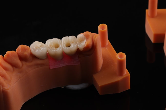 High Quality dental implant crown/bridge Zirconia Crown and All On Four Six Implant Full Arch|China dental lab 16