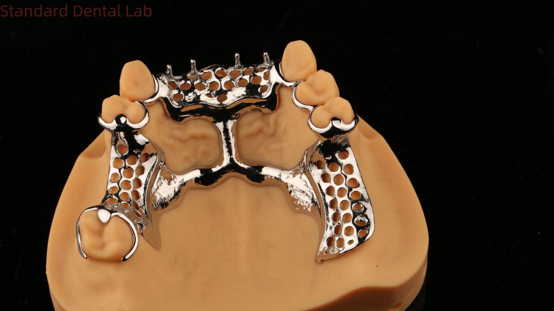 Upper Cast Framework Acrylic Metal Partial Dentures Strong Lightweight and Durable