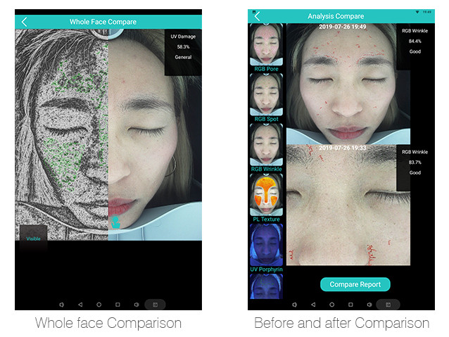 Portable Skin Analyzer Machine , Beauty Skin Testing Analysis Machine