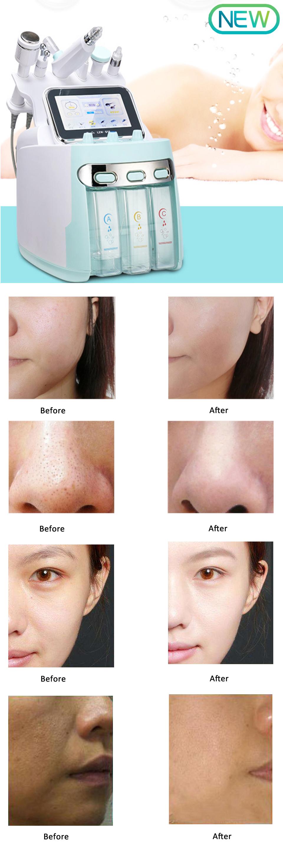Portable H2O2 Oxygen Facial Machine 6 Treatment Handles With 8.4 Inch Touch Screen