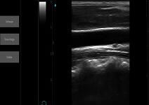 Ultrasound Scan Equipment Portable Ultrasound Scanner Palm Ipad Ultrasound Machine