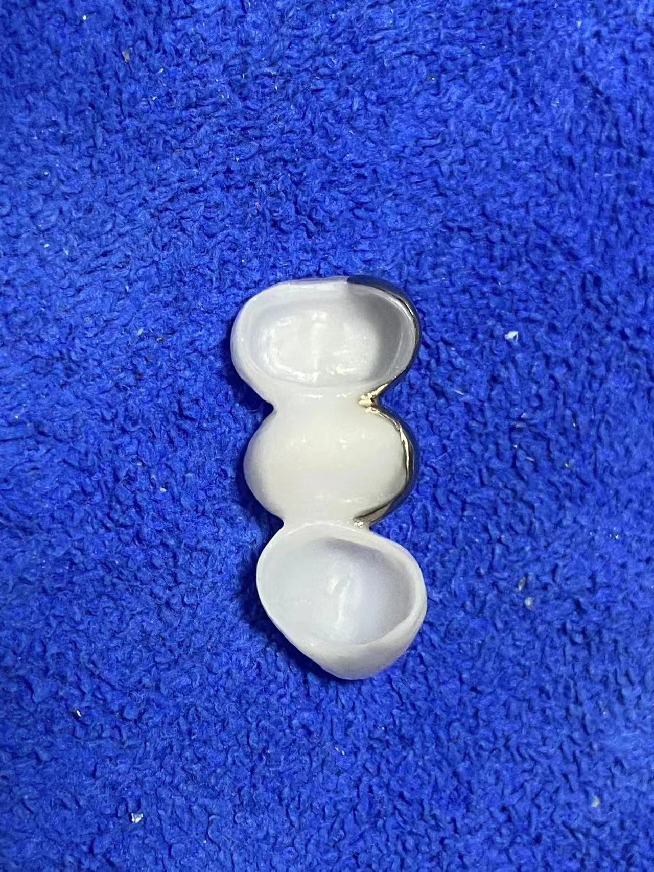 Highly Translucent Zirconia Crowns Bridge Veneers With Customized Jewelry And Gold Beautiful Dental Restoration Case