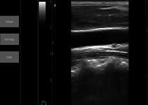 Ultrasound Scan Equipment Portable Ultrasound Scanner Palm Ipad Ultrasound Machine