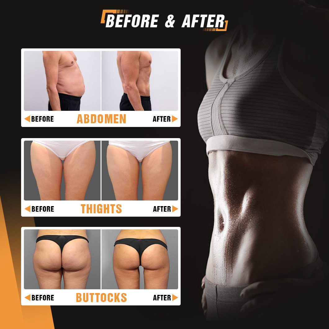 Cooling Air ems sculpting with 40% Fat Reduction 8 Language Support 5000W Power