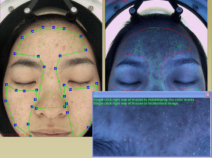 Beauty Salon Skin Scanner Analysis 51*47*66cm Size 64g Hard Disk Space