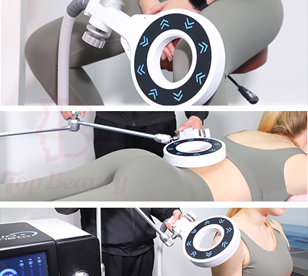 100kHz Extracorporeal Magnetic Therapy Machine Low Back Pain Treatment Sport Recover