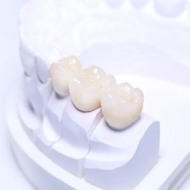 OEM Service Zirconia Dental Crown Professional Dental Laboratory Manufacturer
