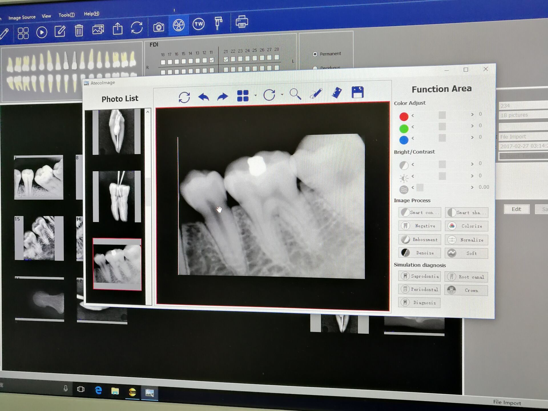 Original Ateco AT-301 UK Wireless Digital Dental X-Ray Sensor