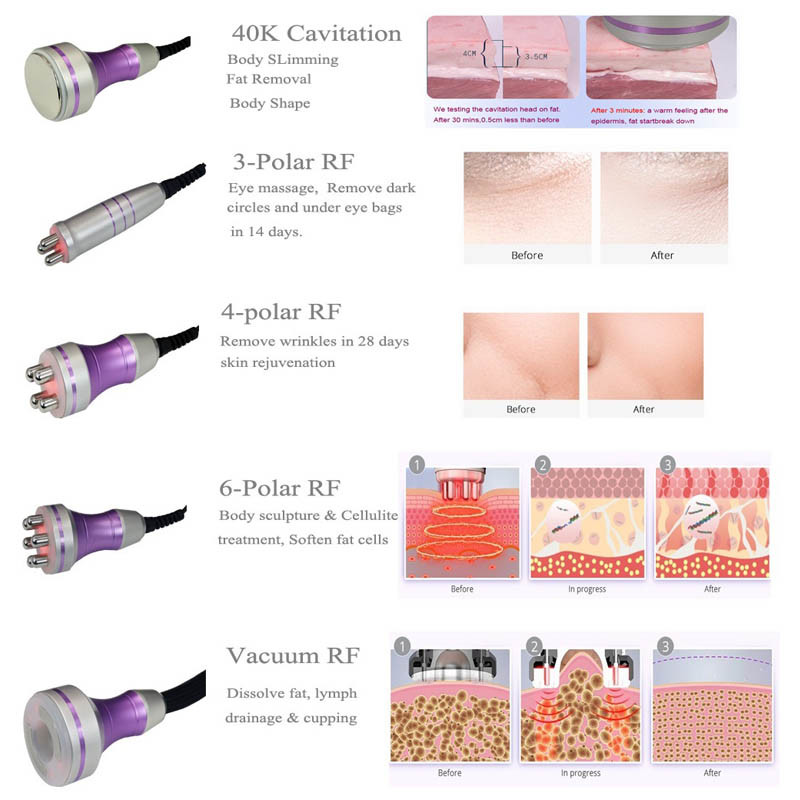5 In 1 Vacuum Rf Infrared Fast Cavitation Slimming Machine For Weight Loss
