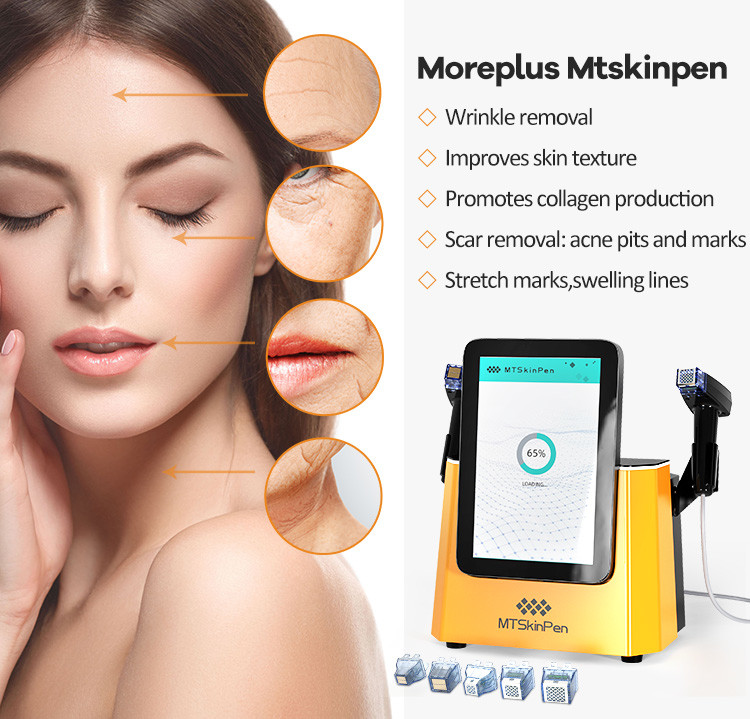 Facial Skin Rejuvenation With Antenna Type Radio Frequency Equipments Ultimate Solution