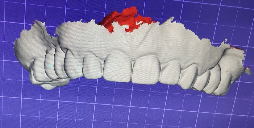 3D Digital Mock Up Teeth Other Dental Products