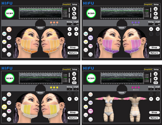 Hifu skin tightening machine cavitation slimming with high quality made in china