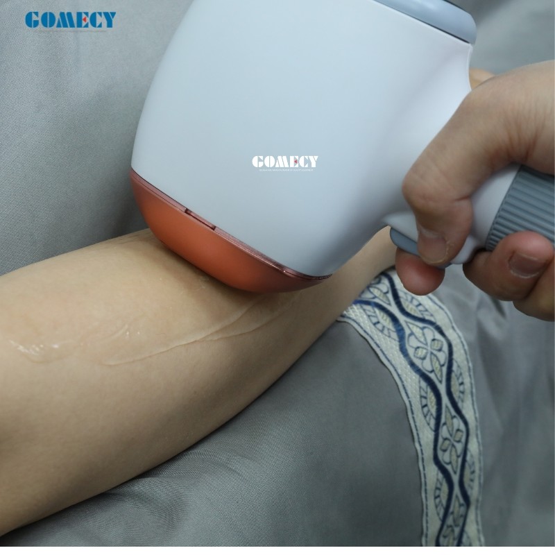 808 Diode Laser Hair Removal Machine Facial Skin Rejuvenation 808 755 1064Nm Laser Diode 808 Nm