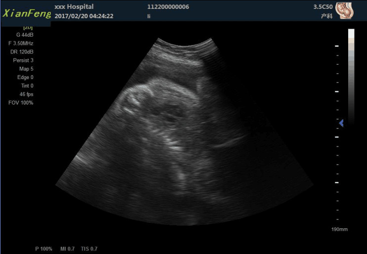 10.4" HD USG Scan Machine Color Doppler Ultrasound Scanner SVGA Output