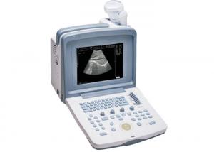 Buy cheap ISO Gray Patient Monitoring System S880 Prime Portable Ultrasound Scanner product