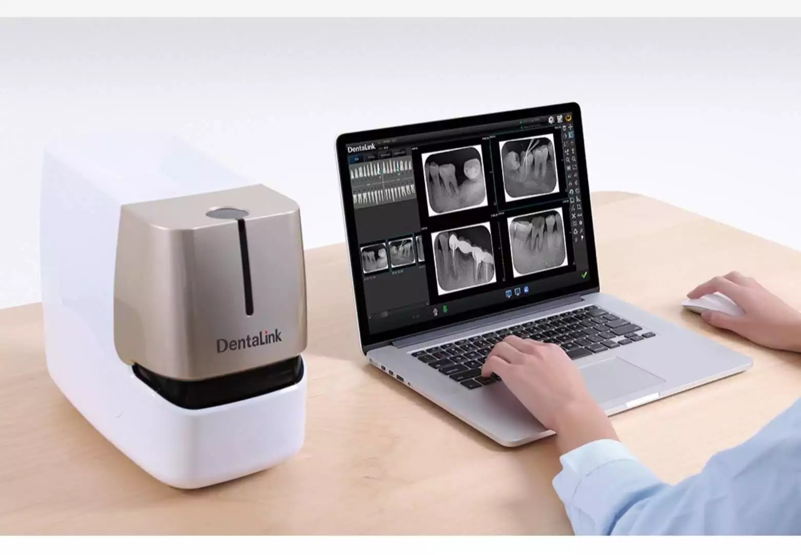 Fussen DentalLink Digitalized Intra oral Imaging Plate X Ray Film Scanner