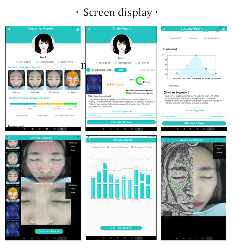 110V 220V Magic Mirror Skin Analyzer Machine 7200K With 2.0 Port USB