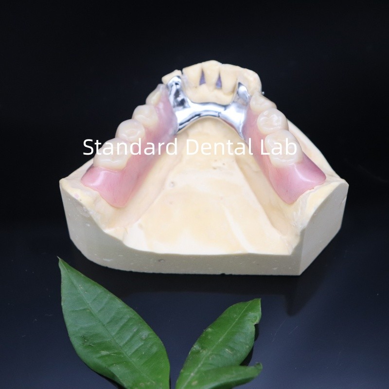 Clear framework Acrylic Metal Partial Denture Frameworks High Esthetics China dental lab
