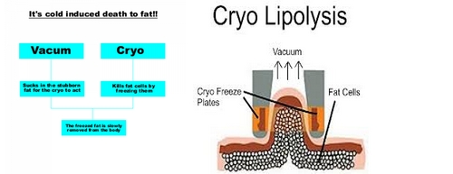 Multi-Functional beauty equipment kryolipolyse cool tech slimming machine cryolipolysis fat freezing equipment