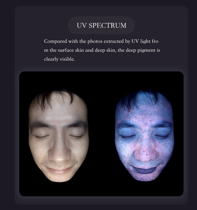 Professional Skin Analyzer Machine AI Powered Skin Diagnosis Machine
