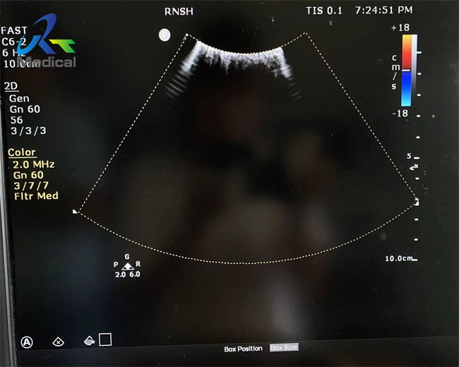 C6-2 Convex Array Transducer Probe Ultrasound Crystal and Lens Array Replacement